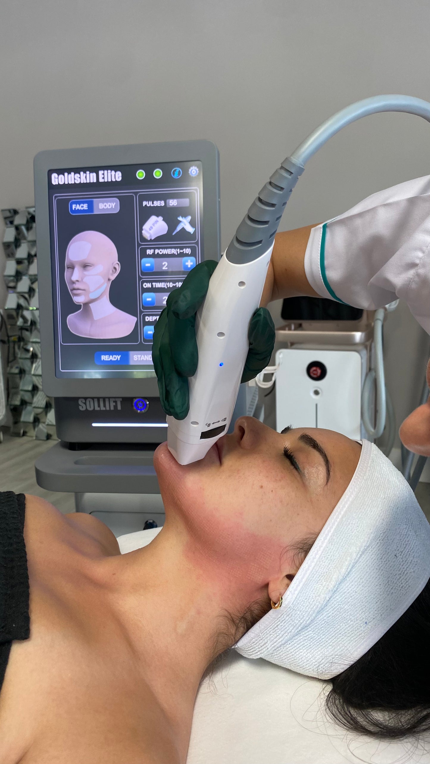 Torno Advanced Diode and Goldskin Elite Microneedling