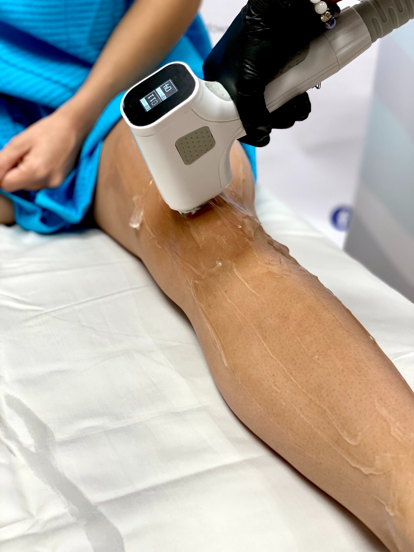 Torno Advanced Diode and Goldskin Elite Microneedling