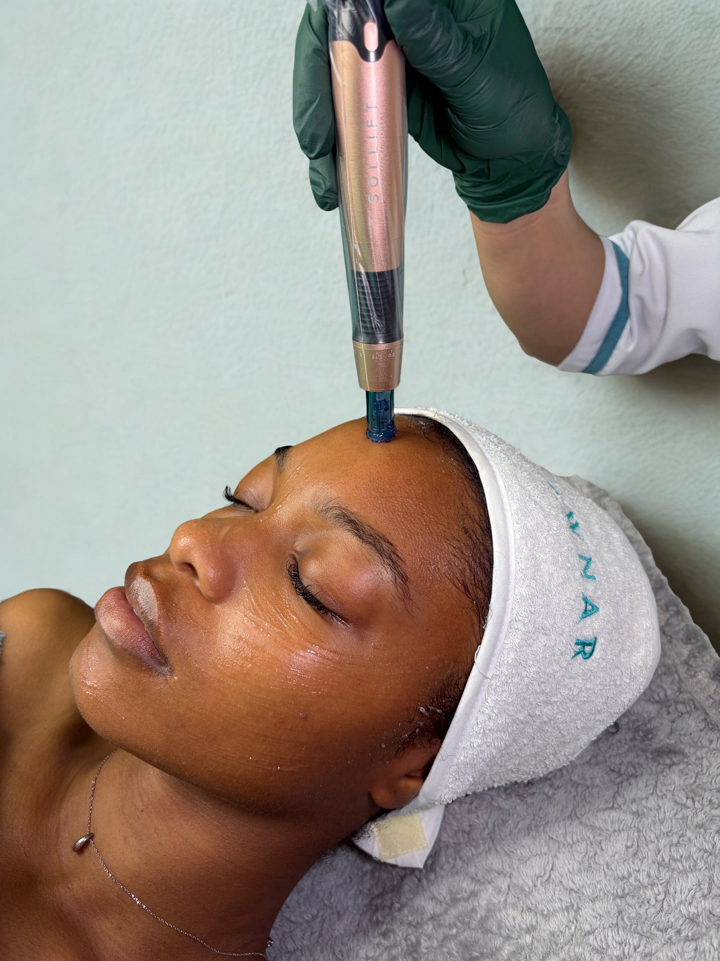 Velvet Microneedling Pen (FDA-Cleared medical grade - CE and Health Canada Approved)