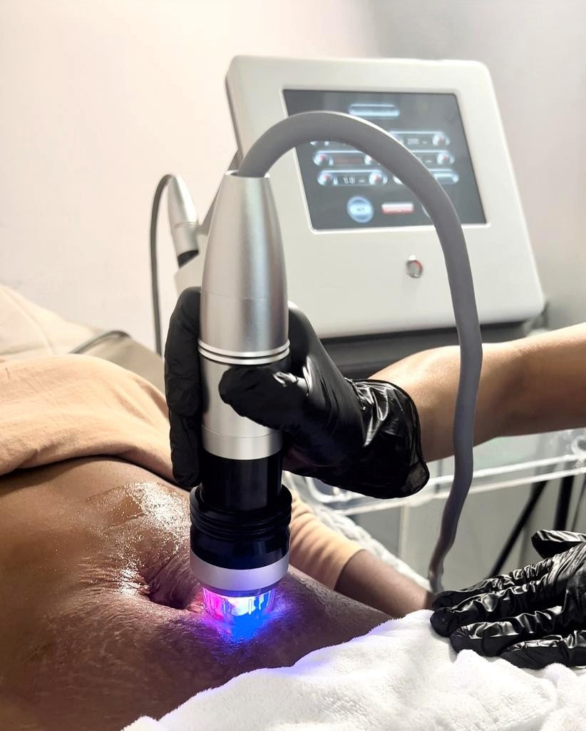 Goldskin Fractional Micro Needle RF